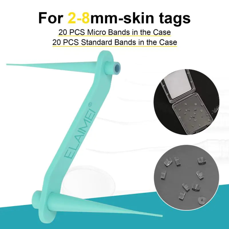 Cutting-Edge Automatic Skin Label Removal Kit